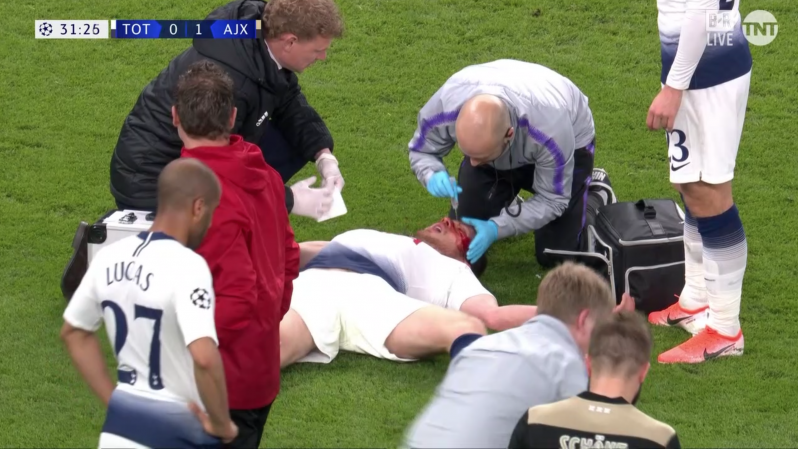 Jan Vertonghen Injury