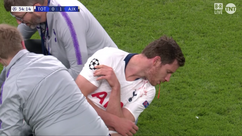 Jan Vertonghen Injury