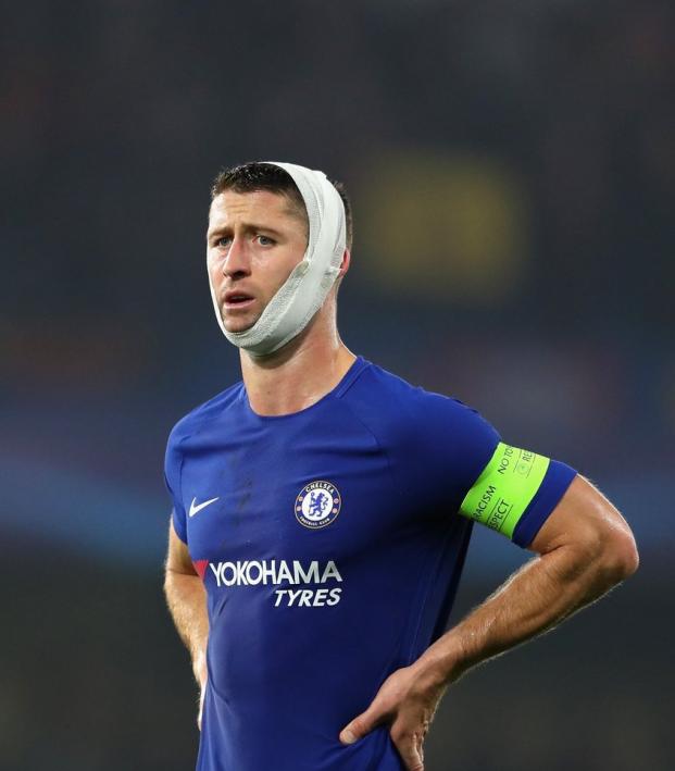 Gary Cahill Head Wrap Champions League