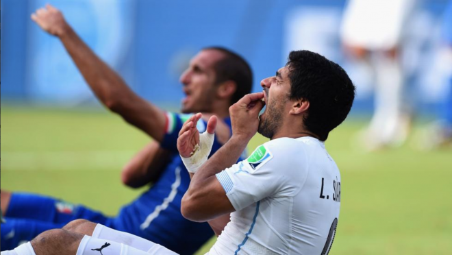 Luis Suarez Bite